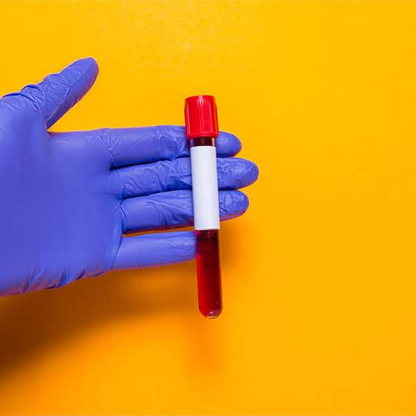 Anemia